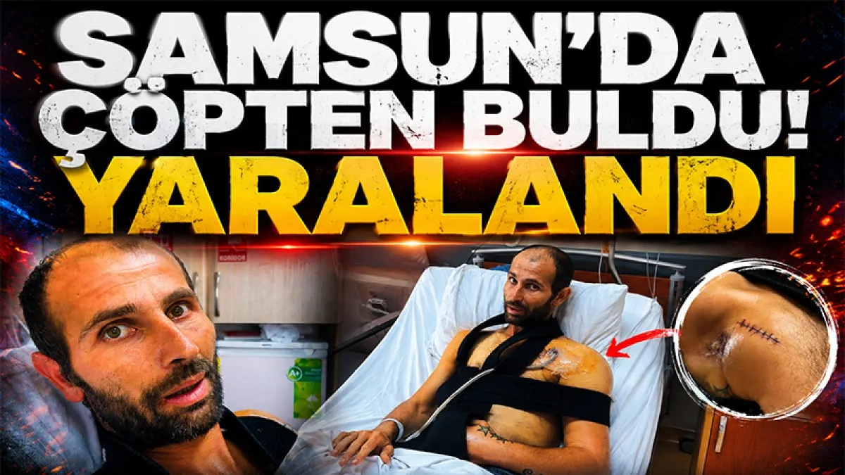 Samsun'da çöpten buldu! Yaralandı